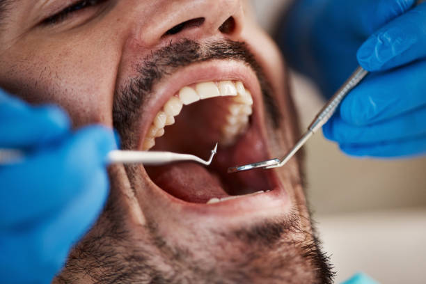 Best Dentist for Tooth Abscess  in Hondo, TX